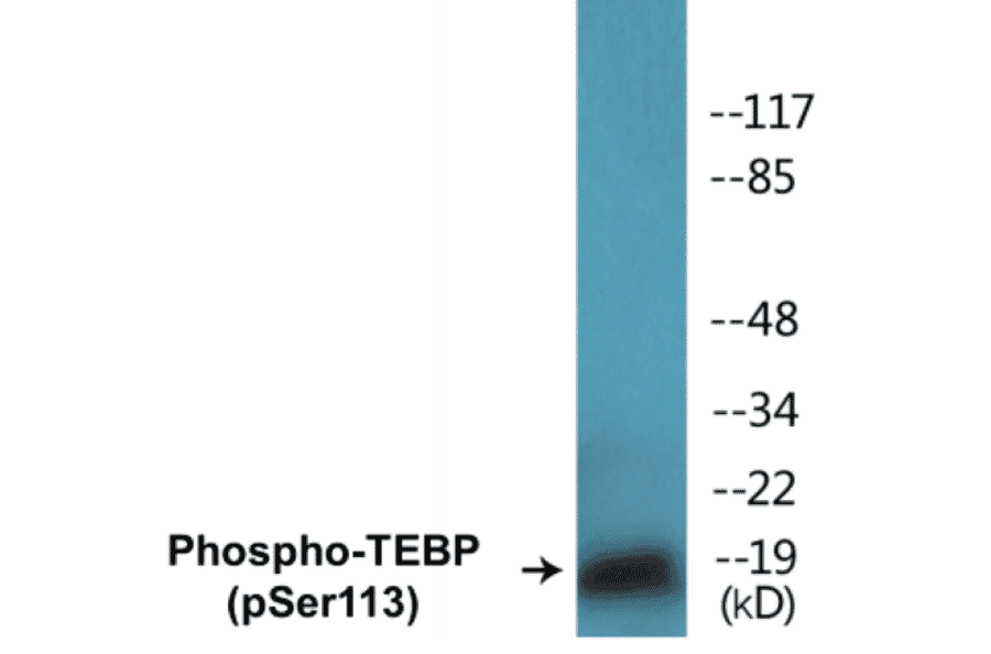 Western Blot - TEBP (phospho Ser113) Cell Based ELISA Kit (CBP1222) - Antibodies.com
