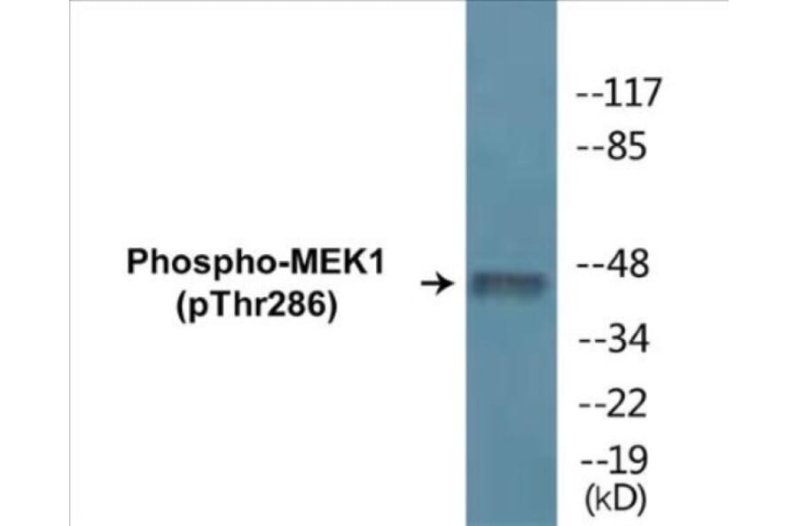 Western Blot - MEK1 (phospho Thr286) Cell Based ELISA Kit (CBP1260) - Antibodies.com
