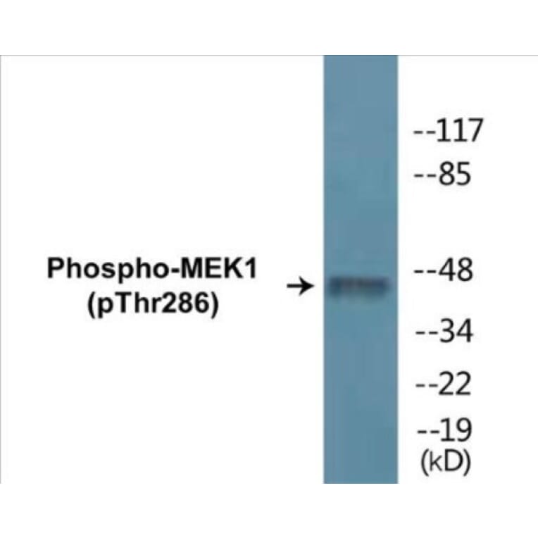 Western Blot - MEK1 (phospho Thr286) Cell Based ELISA Kit (CBP1260) - Antibodies.com