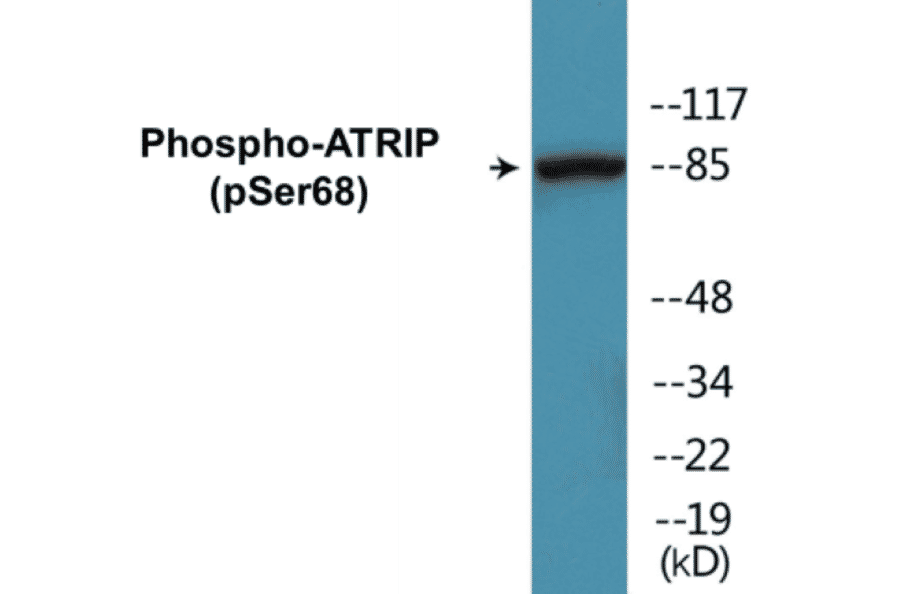Western Blot - ATRIP (phospho Ser68) Cell Based ELISA Kit (CBP1294) - Antibodies.com