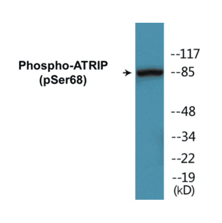Western Blot - ATRIP (phospho Ser68) Cell Based ELISA Kit (CBP1294) - Antibodies.com