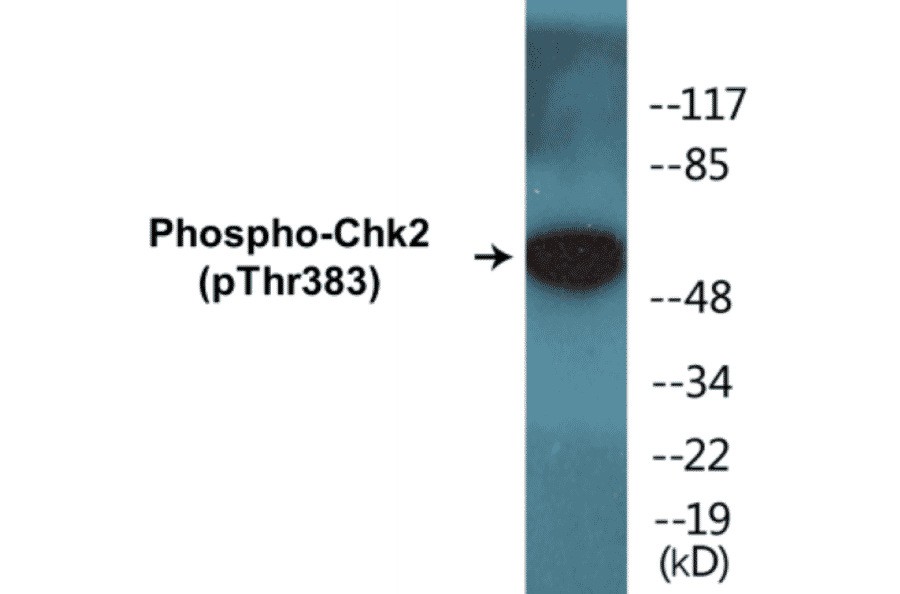 Western Blot - Chk2 (phospho Thr383) Cell Based ELISA Kit (CBP1299) - Antibodies.com