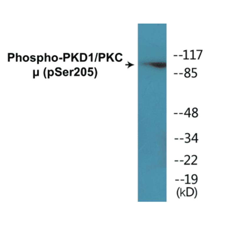 Western Blot - PKD1 (phospho Ser205) Cell Based ELISA Kit (CBP1311) - Antibodies.com