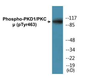 Western Blot - PKD1 (phospho Tyr463) Cell Based ELISA Kit (CBP1312) - Antibodies.com