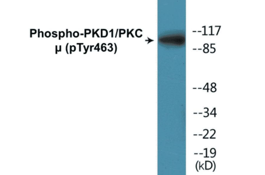 Western Blot - PKD1 (phospho Tyr463) Cell Based ELISA Kit (CBP1312) - Antibodies.com