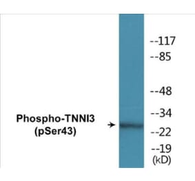 Western Blot - TNNI3 (phospho Ser43) Cell Based ELISA Kit (CBP1317) - Antibodies.com
