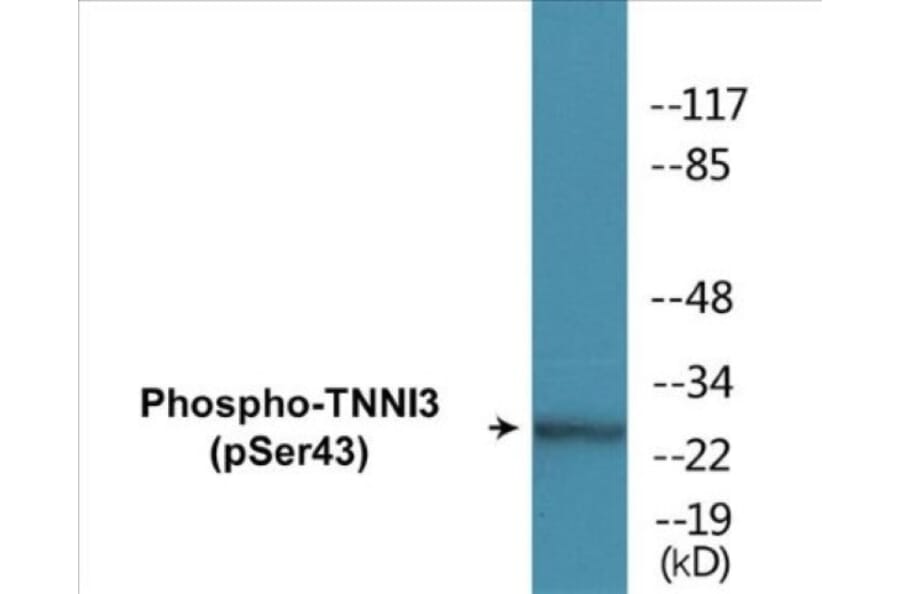 Western Blot - TNNI3 (phospho Ser43) Cell Based ELISA Kit (CBP1317) - Antibodies.com