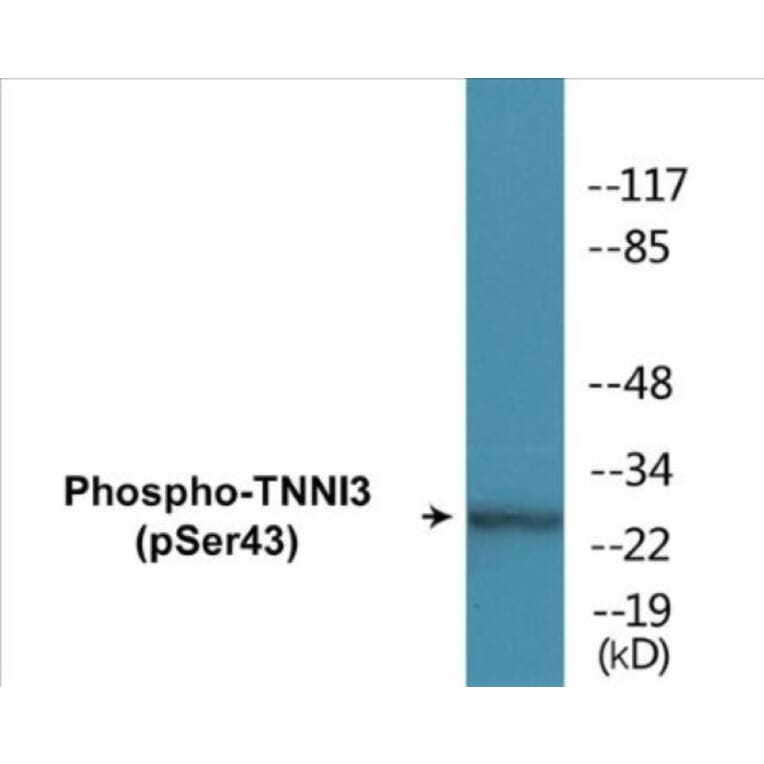 Western Blot - TNNI3 (phospho Ser43) Cell Based ELISA Kit (CBP1317) - Antibodies.com