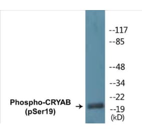 Western Blot - CRYAB (phospho Ser19) Cell Based ELISA Kit (CBP1358) - Antibodies.com