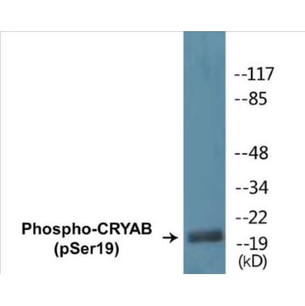 Western Blot - CRYAB (phospho Ser19) Cell Based ELISA Kit (CBP1358) - Antibodies.com