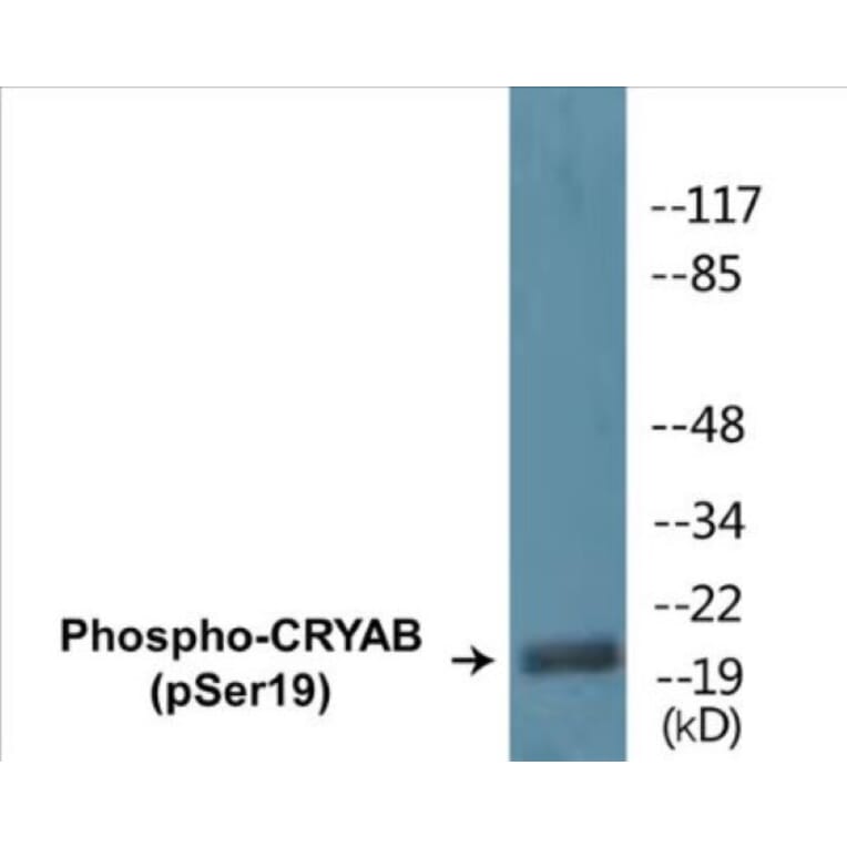 Western Blot - CRYAB (phospho Ser19) Cell Based ELISA Kit (CBP1358) - Antibodies.com