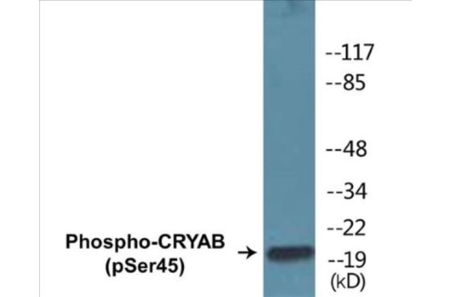 Western Blot - CRYAB (phospho Ser45) Cell Based ELISA Kit (CBP1359) - Antibodies.com