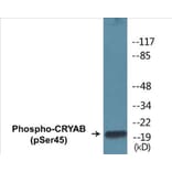Western Blot - CRYAB (phospho Ser45) Cell Based ELISA Kit (CBP1359) - Antibodies.com