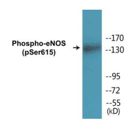 Western Blot - eNOS (phospho Ser615) Cell Based ELISA Kit (CBP1447) - Antibodies.com