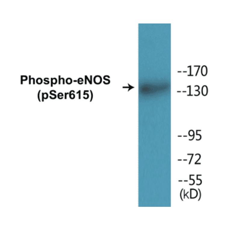 Western Blot - eNOS (phospho Ser615) Cell Based ELISA Kit (CBP1447) - Antibodies.com