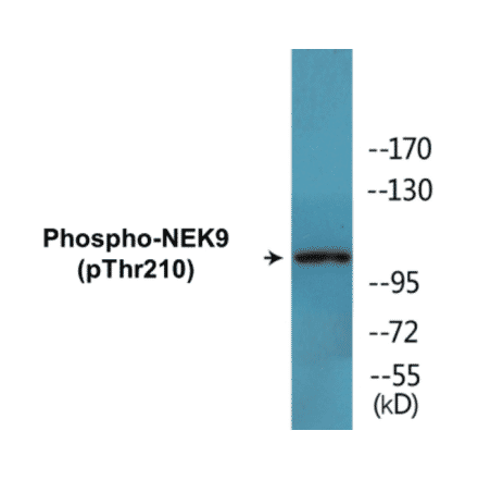 Western Blot - NEK9 (phospho Thr210) Cell Based ELISA Kit (CBP1452) - Antibodies.com