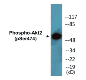 Western Blot - Akt2 (phospho Ser474) Cell Based ELISA Kit (CBP1491) - Antibodies.com