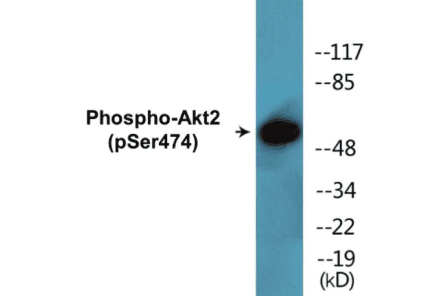 Western Blot - Akt2 (phospho Ser474) Cell Based ELISA Kit (CBP1491) - Antibodies.com