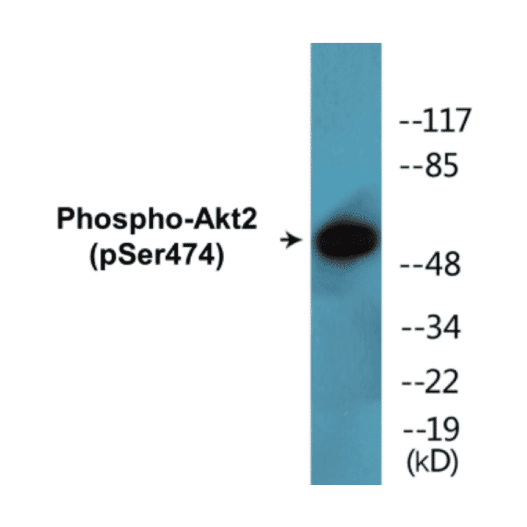 Western Blot - Akt2 (phospho Ser474) Cell Based ELISA Kit (CBP1491) - Antibodies.com