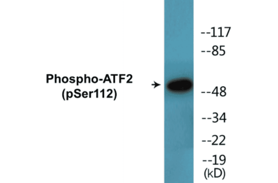 Western Blot - ATF2 (phospho Ser112) Cell Based ELISA Kit (CBP1495) - Antibodies.com