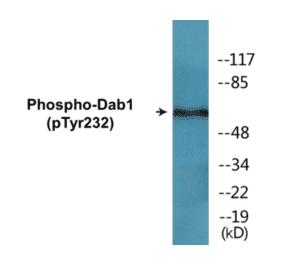 Western Blot - Dab1 (phospho Tyr232) Cell Based ELISA Kit (CBP1527) - Antibodies.com