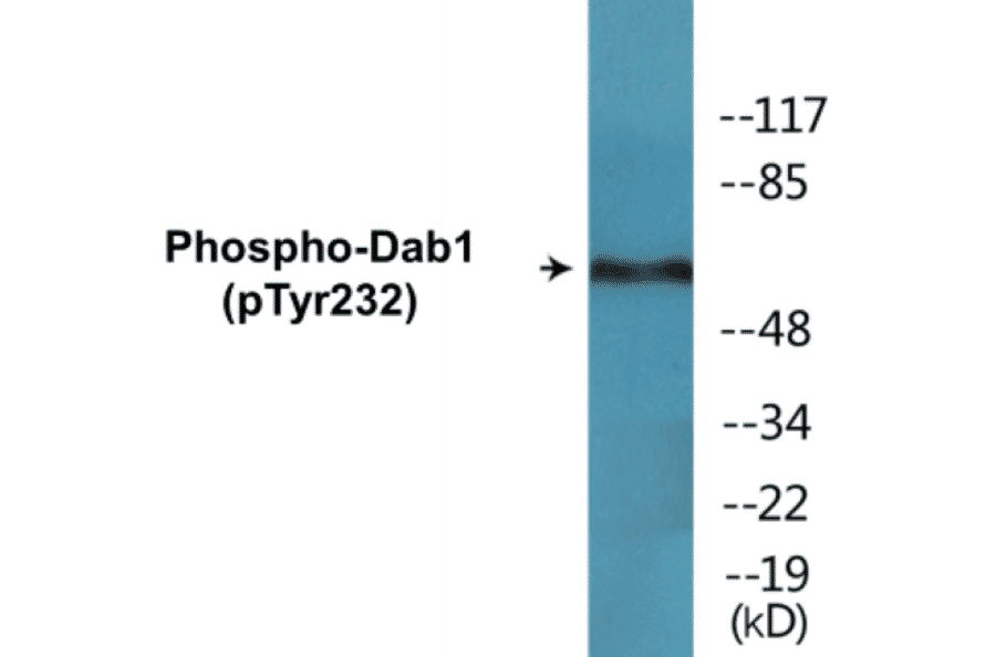 Western Blot - Dab1 (phospho Tyr232) Cell Based ELISA Kit (CBP1527) - Antibodies.com