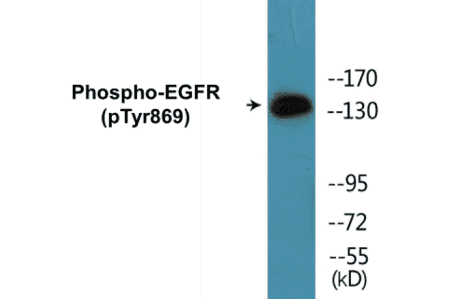 Western Blot - EGFR (phospho Tyr869) Cell Based ELISA Kit (CBP1537) - Antibodies.com