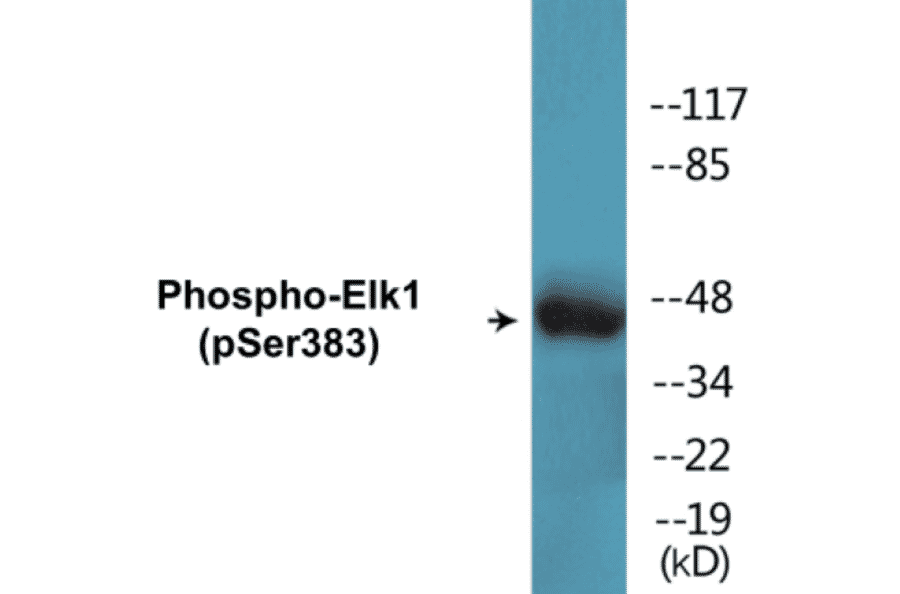 Western Blot - Elk1 (phospho Ser383) Cell Based ELISA Kit (CBP1540) - Antibodies.com