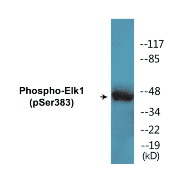 Western Blot - Elk1 (phospho Ser383) Cell Based ELISA Kit (CBP1540) - Antibodies.com