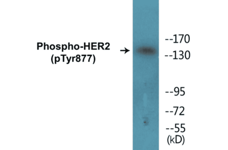 Western Blot - HER2 (phospho Tyr877) Cell Based ELISA Kit (CBP1574) - Antibodies.com