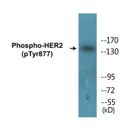Western Blot - HER2 (phospho Tyr877) Cell Based ELISA Kit (CBP1574) - Antibodies.com