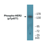 Western Blot - HER2 (phospho Tyr877) Cell Based ELISA Kit (CBP1574) - Antibodies.com