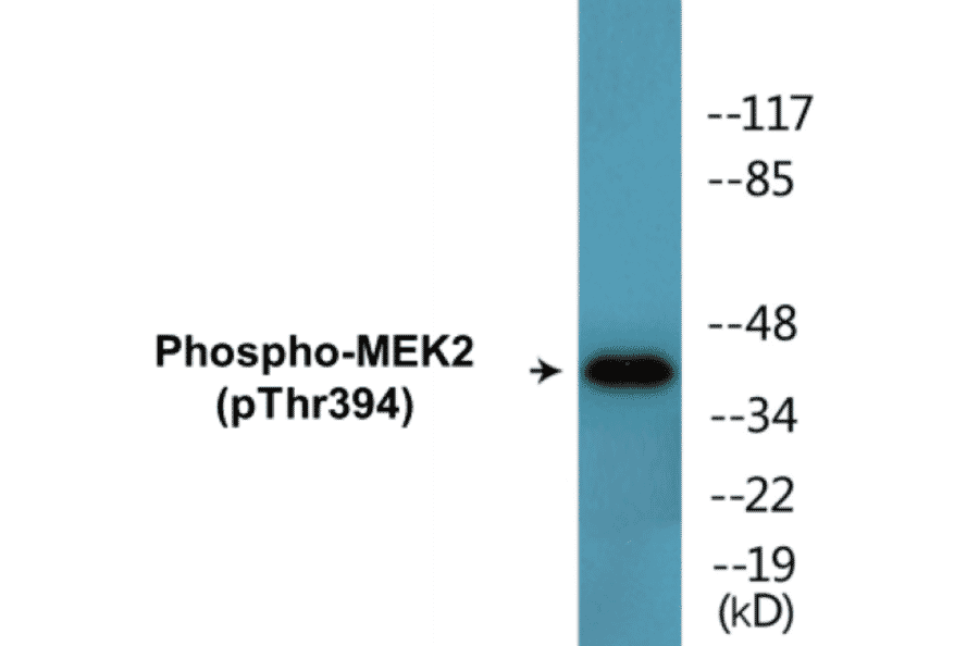 Western Blot - MEK2 (phospho Thr394) Cell Based ELISA Kit (CBP1613) - Antibodies.com