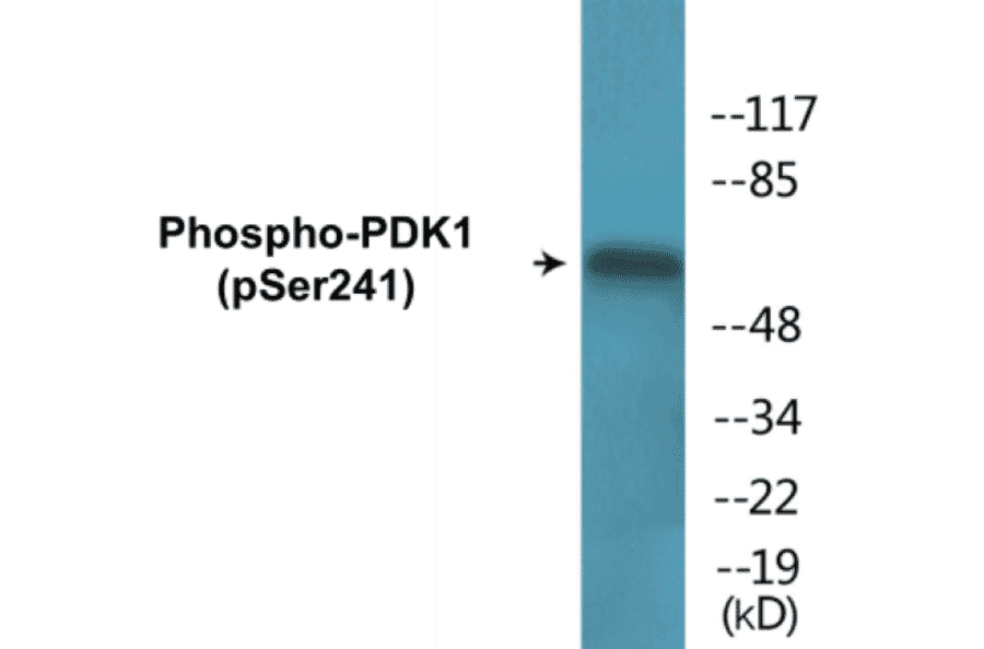 Western Blot - PDK1 (phospho Ser241) Cell Based ELISA Kit (CBP1656) - Antibodies.com