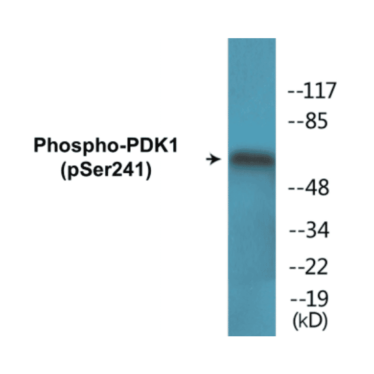 Western Blot - PDK1 (phospho Ser241) Cell Based ELISA Kit (CBP1656) - Antibodies.com