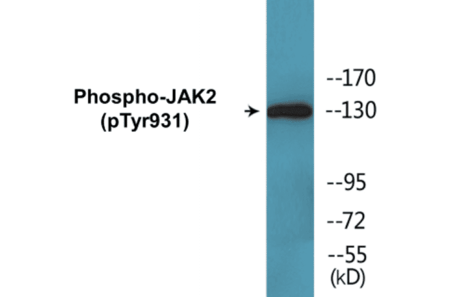 Western Blot - JAK2 (phospho Tyr931) Cell Based ELISA Kit (CBP1747) - Antibodies.com