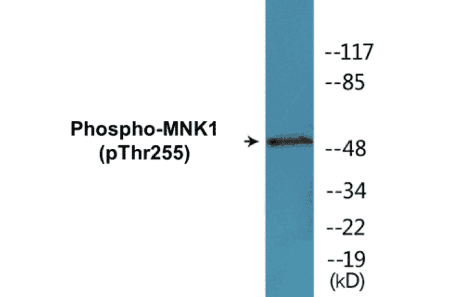 Western Blot - MNK1 (phospho Thr255) Cell Based ELISA Kit (CBP1756) - Antibodies.com