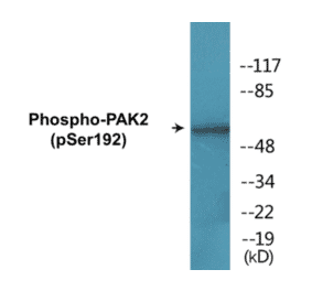 Western Blot - PAK2 (phospho Ser192) Cell Based ELISA Kit (CBP1762) - Antibodies.com