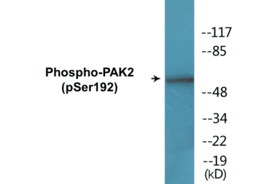 Western Blot - PAK2 (phospho Ser192) Cell Based ELISA Kit (CBP1762) - Antibodies.com