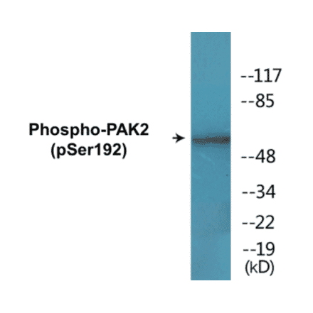 Western Blot - PAK2 (phospho Ser192) Cell Based ELISA Kit (CBP1762) - Antibodies.com