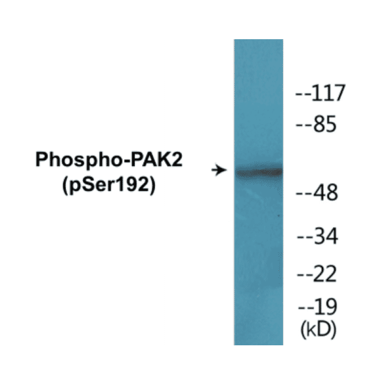 Western Blot - PAK2 (phospho Ser192) Cell Based ELISA Kit (CBP1762) - Antibodies.com