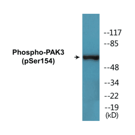 Western Blot - PAK3 (phospho Ser154) Cell Based ELISA Kit (CBP1764) - Antibodies.com