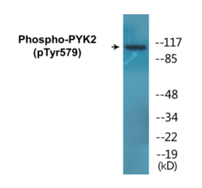 Western Blot - PYK2 (phospho Tyr579) Cell Based ELISA Kit (CBP1801) - Antibodies.com