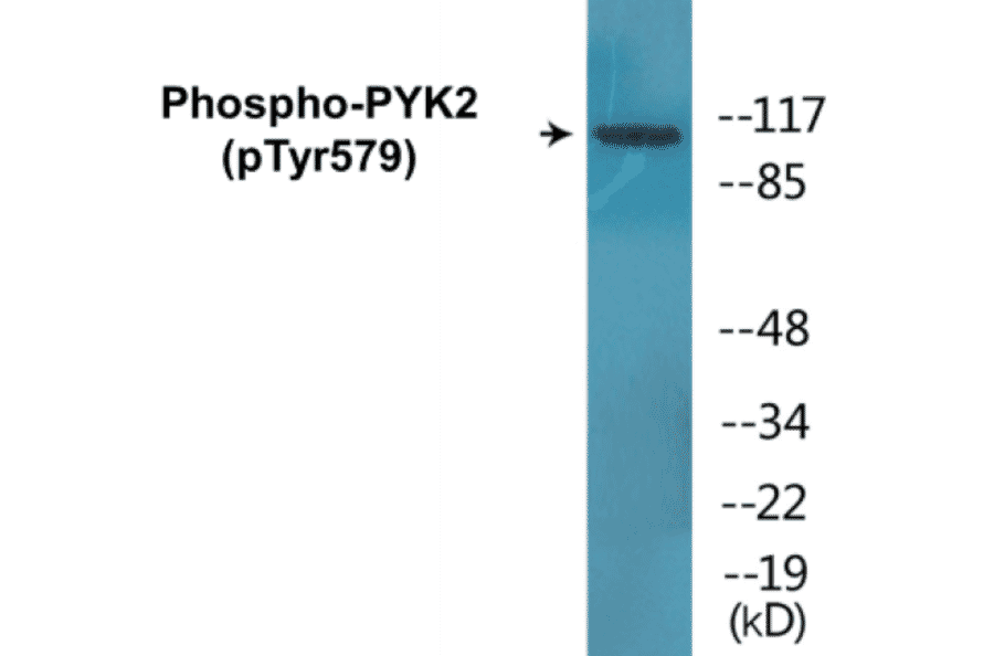 Western Blot - PYK2 (phospho Tyr579) Cell Based ELISA Kit (CBP1801) - Antibodies.com