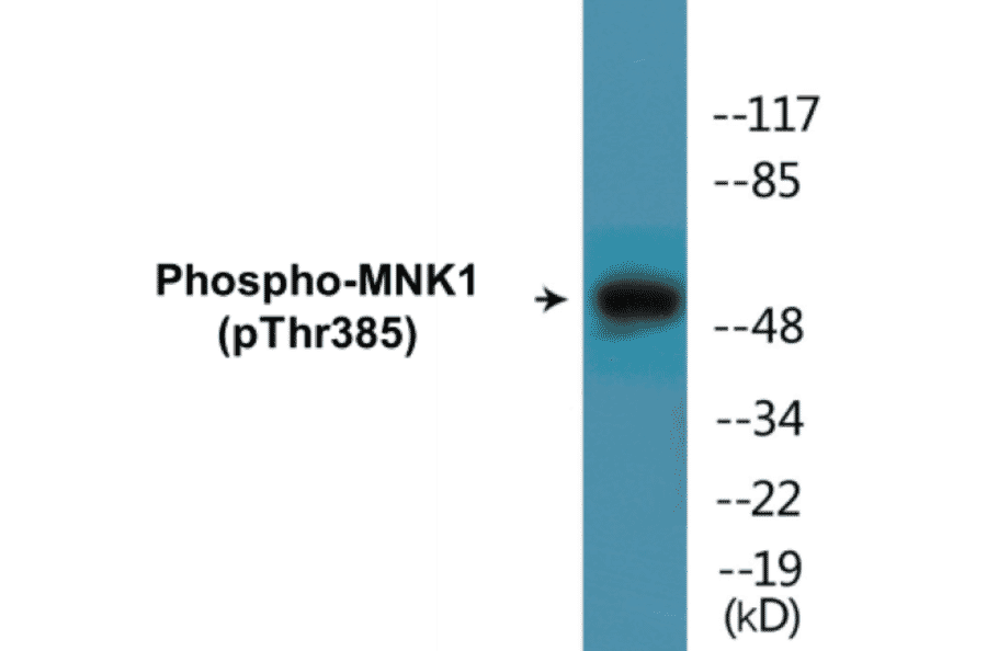 Western Blot - MNK1 (phospho Thr385) Cell Based ELISA Kit (CBP1829) - Antibodies.com