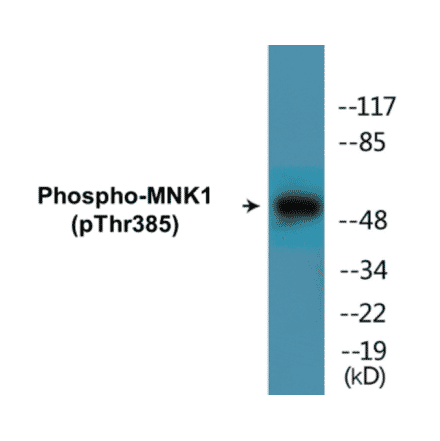 Western Blot - MNK1 (phospho Thr385) Cell Based ELISA Kit (CBP1829) - Antibodies.com
