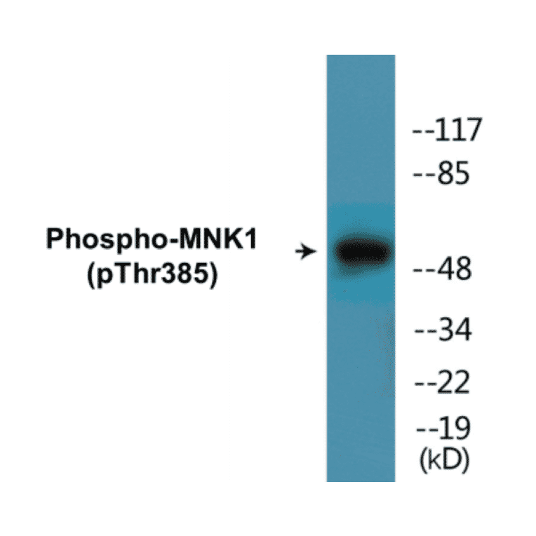 Western Blot - MNK1 (phospho Thr385) Cell Based ELISA Kit (CBP1829) - Antibodies.com