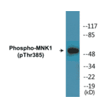 Western Blot - MNK1 (phospho Thr385) Cell Based ELISA Kit (CBP1829) - Antibodies.com