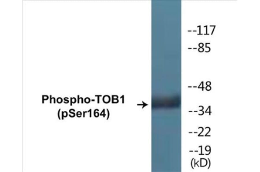 Western Blot - TOB1 (phospho Ser164) Cell Based ELISA Kit (CBP1842) - Antibodies.com