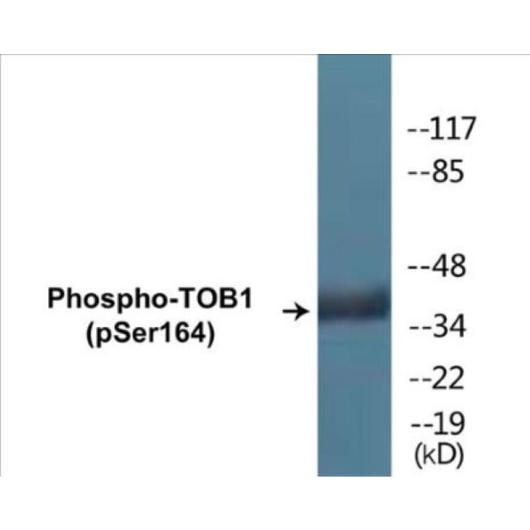 Western Blot - TOB1 (phospho Ser164) Cell Based ELISA Kit (CBP1842) - Antibodies.com